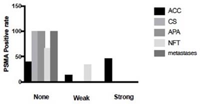 Diagnostic Role of Prostate-Specific Membrane Antigen in Adrenocortical Carcinoma